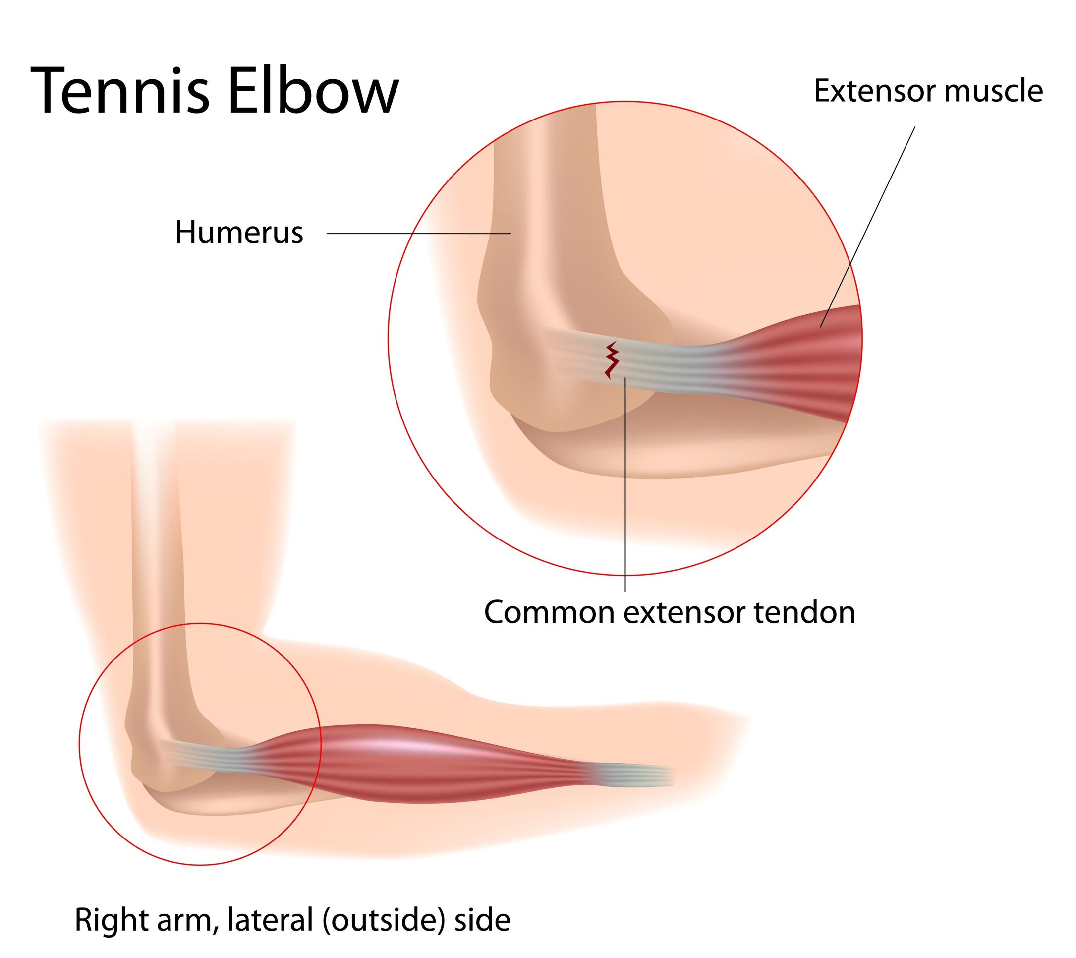 elbow anatomy