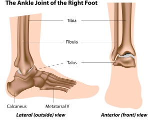 Sprained Ankle