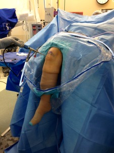 Arthroscopy