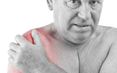 When is Rotator Cuff Surgery Recommended?