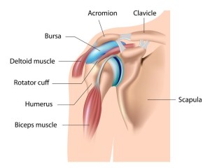 Impingement Syndrome Symptoms