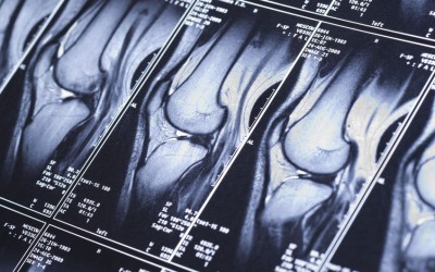 MRI Readings: Fact or Fiction?