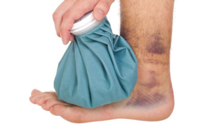 Ankle Fracture Symptoms: What Are They?
