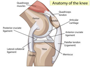 Patellar Tendon Tear